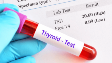 Thyroid Function Test