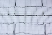 driving strategic excellence forward