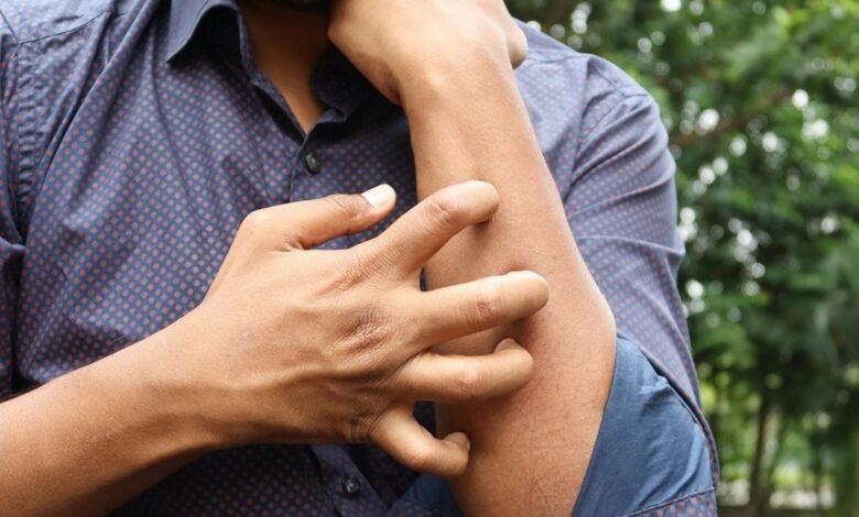 medical topic dermatitis health discussions